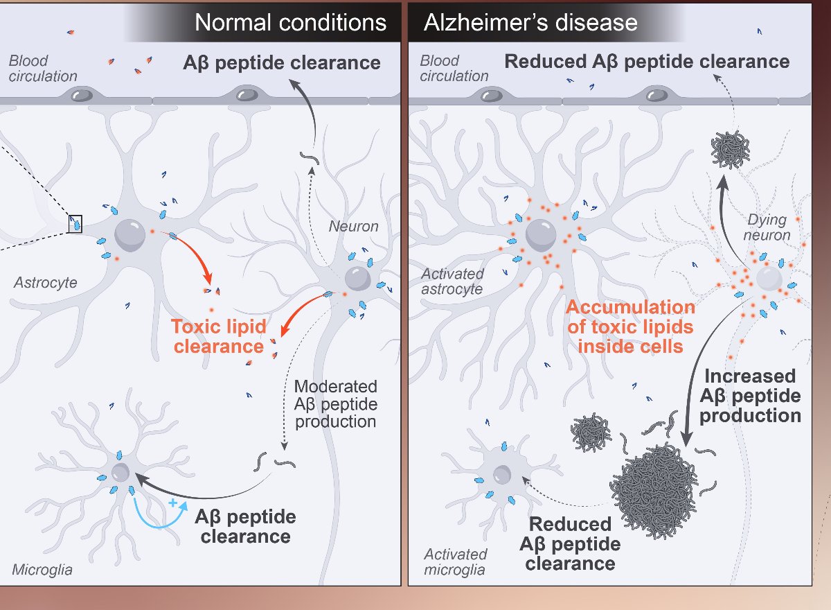 Diagram of toxic lipid and Aβ peptide clearance pathways, normal versus Alzheimer's disease